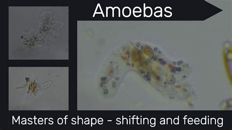  Xeramoeba! A Microscopic Master of Shape-Shifting