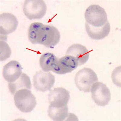  Babesia: ¡Un parásito microscópico que te hace bailar la macarena!