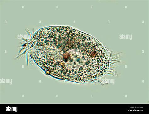  Oxytrichia: ¡Un Ciliado Microscópico que Desafía la Gravedad con Sus Cílios!